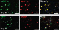 Six slides of neuron scans